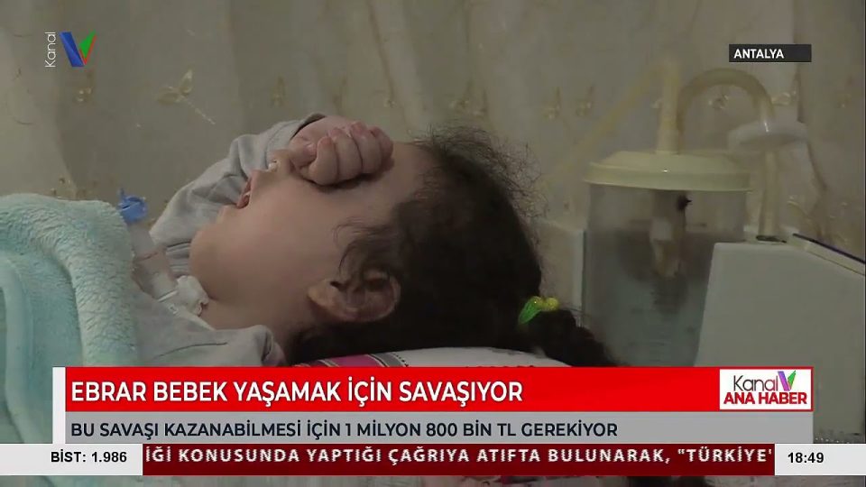 EBRAK Bebek Yaşamak İçin Savaşıyor - Destek Olun !