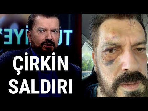 Hakan Bayrakçı Saldırıya Maruz Kaldı - Teksas gibi memleket